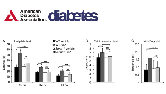 翟琦巍研究组发现防治糖尿病外周神经病变的新靶点