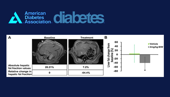 中国科学院上海营养与健康研究所与天士力生物合作发表新型FGF21类似物治疗非人灵长类动物非酒精性脂肪性肝炎的研究成果