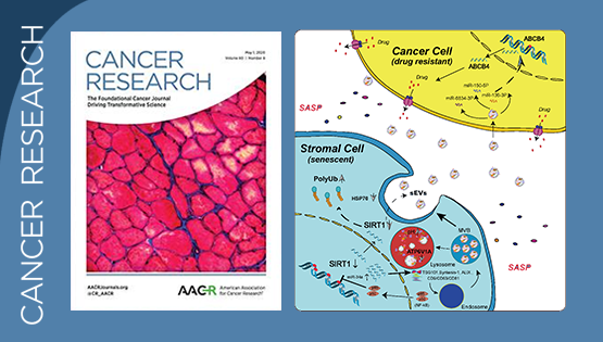 孙宇研究组发现衰老细胞衍生小胞外囊泡并引发微环境中癌细胞获得性耐药的关键机制