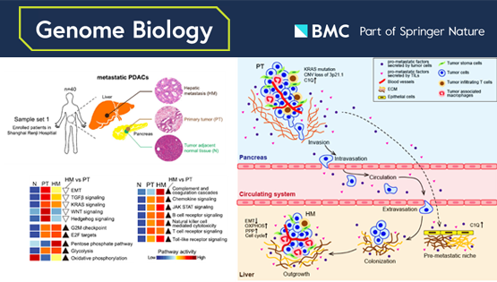 李虹、李亦学研究组合作破译胰腺癌肝转移的分子特征