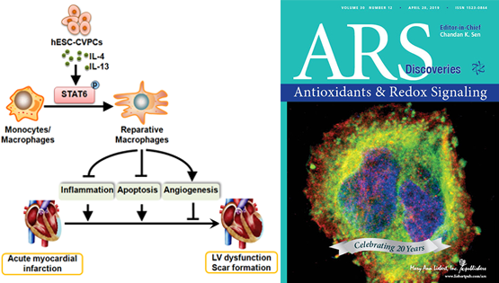 杨黄恬研究组揭示人胚胎干细胞（hESCs）来源的心血管前体细胞（CVPCs）移植对急性心肌梗死的保护作用