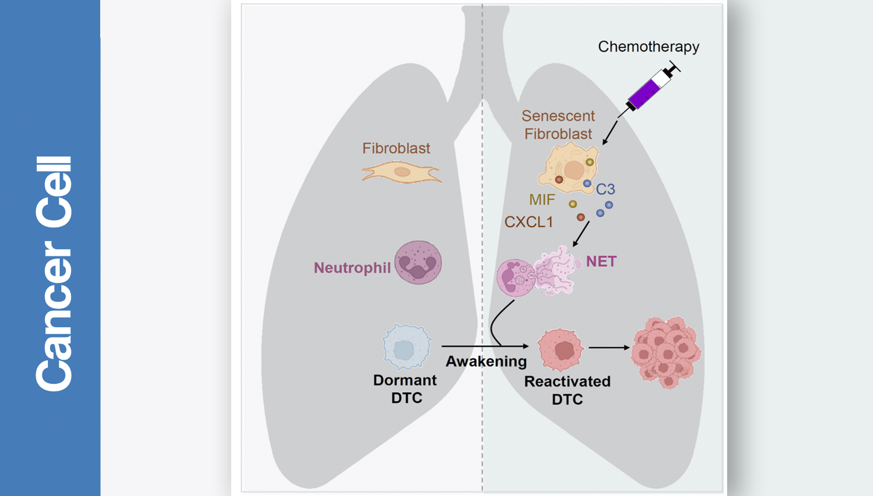 营养与健康所胡国宏研究组揭示化疗唤醒休眠乳腺癌细胞导致转移复发